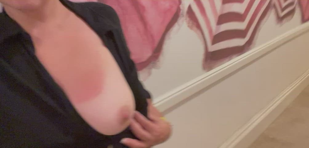 I love this hotel 🏨 so classic. My poor sunburned titties the same color as wall. [GIF] : video clip
